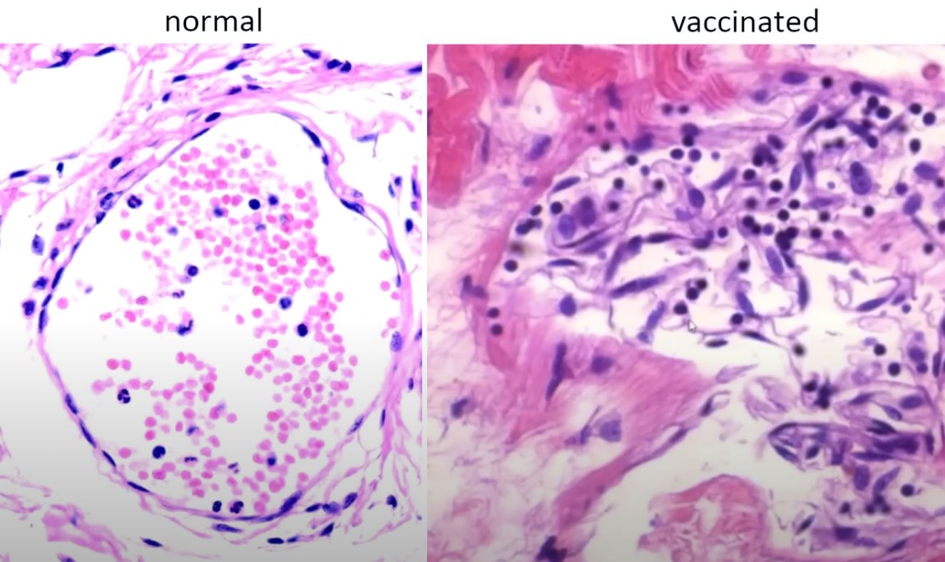 normal versus vax endothelium